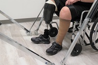 Image of an interim prosthetic leg being worn by a man sitting in a wheelchair