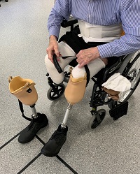Image of male patient trying on a set of prosthetic lower limbs